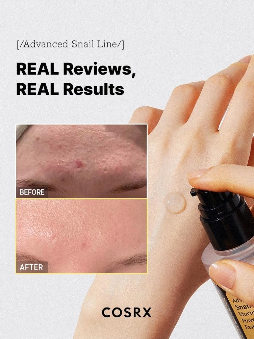COSRX Advanced Snail 96 Mucin Power Essence- Ενυδατικό essence με βλεννίνη σαλιγκαριού - Image 5